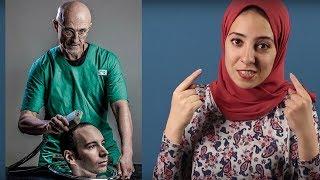 عملية زراعة الرأس !